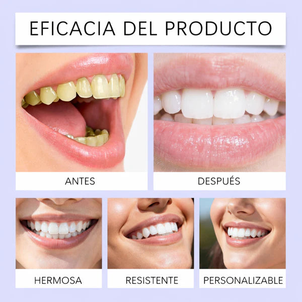 🦷 Tiras Blanqueadoras Dentales MEANSMIL